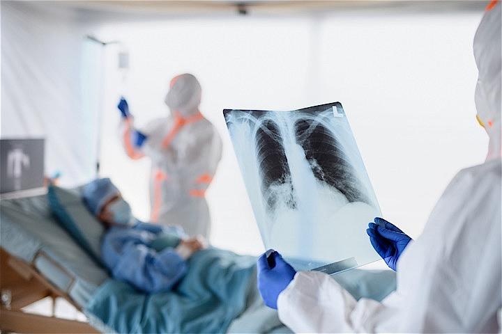 肺の疾患のイメージ