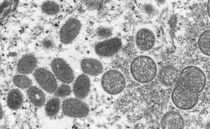 サル痘ウイルスの電子顕微鏡画像
